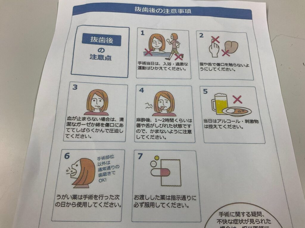 抜歯