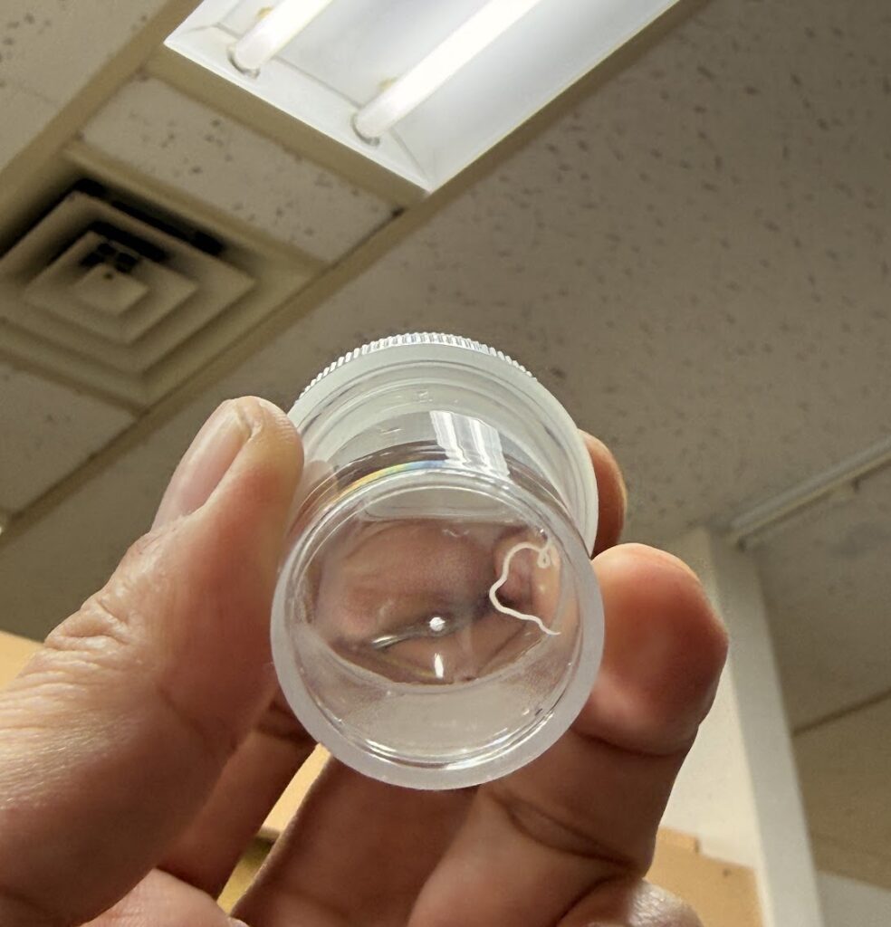 人間ドックとアニサキス