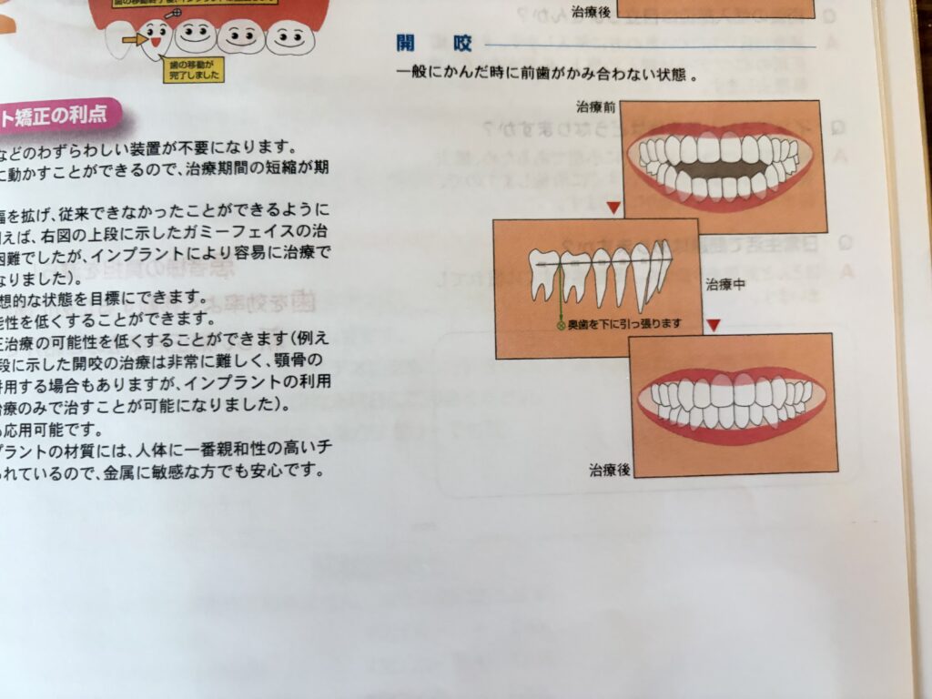 どうするかい？